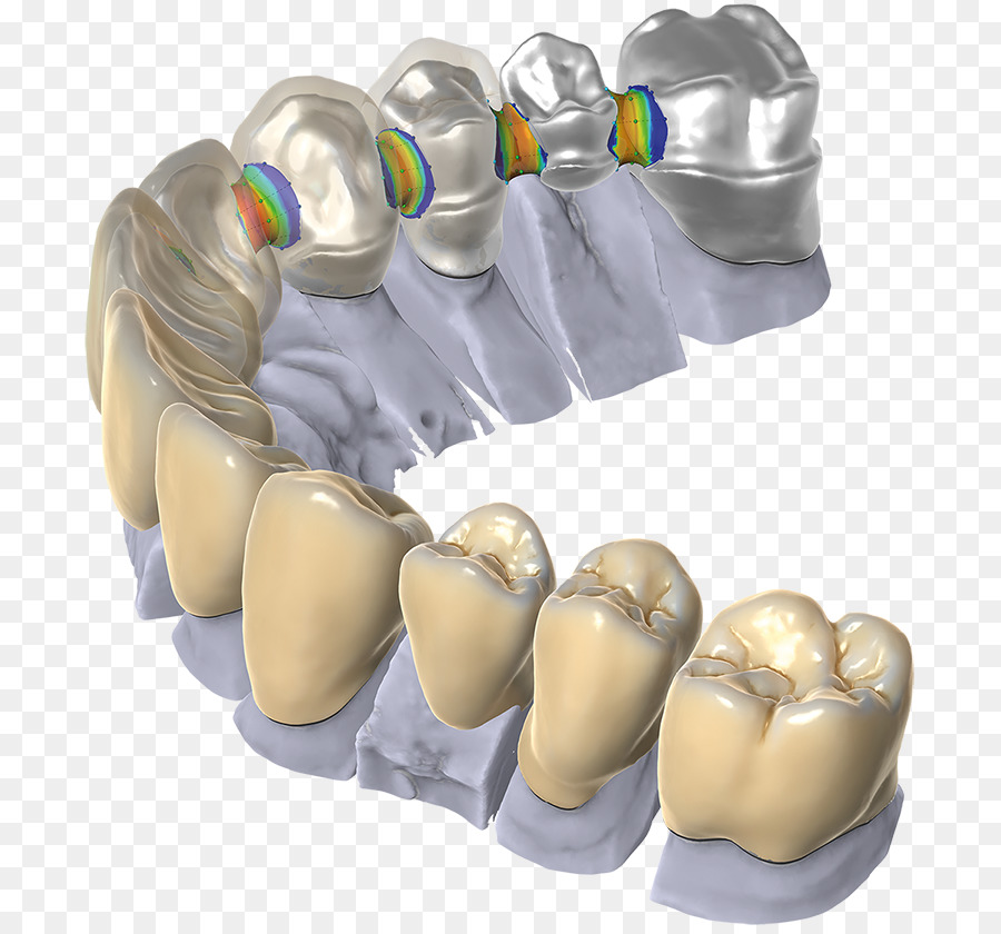kisspng-cad-cam-dentistry-computer-aided-design-dental-res-5afee1398629e5.6298496015266532415496